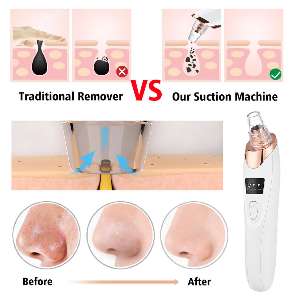 Vacuum Blackhead Remover For Pore Acne Pimple Removal and Vacuum Suction Facial Pore Cleaner