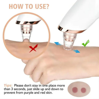 Vacuum Blackhead Remover For Pore Acne Pimple Removal and Vacuum Suction Facial Pore Cleaner
